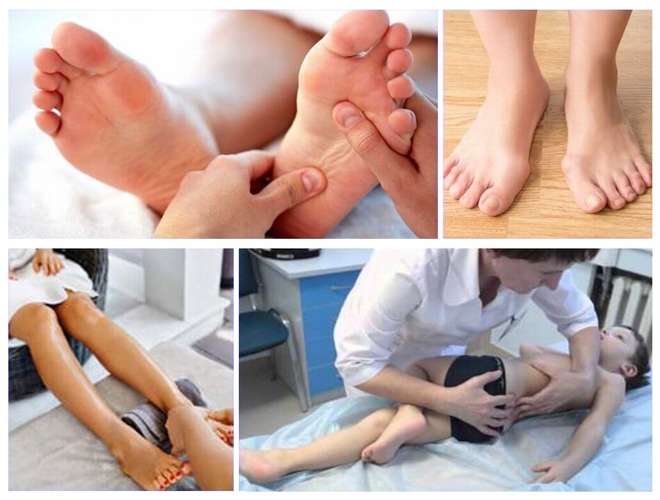 Deformation of Valgus in Child Treatment