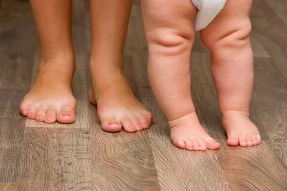 Valgus deformation in children