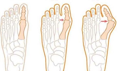 Foot development