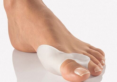Silicone lock for thumb leg