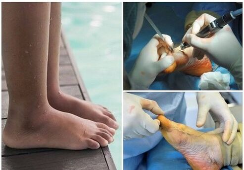 Small-Invasive surgical treatment