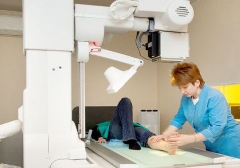 X -ray legs